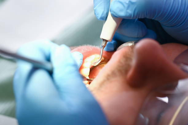 Best Emergency Gum Treatment in Piednt, MO