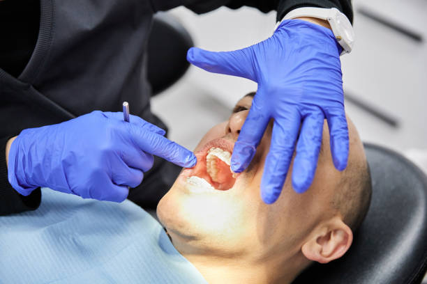 Best Emergency Tooth Extraction in Piednt, MO