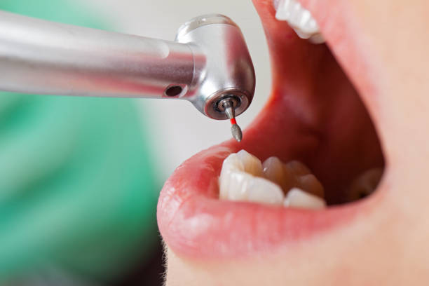 Best Emergency Treatment for Dental Infections or Abscesses in Piednt, MO